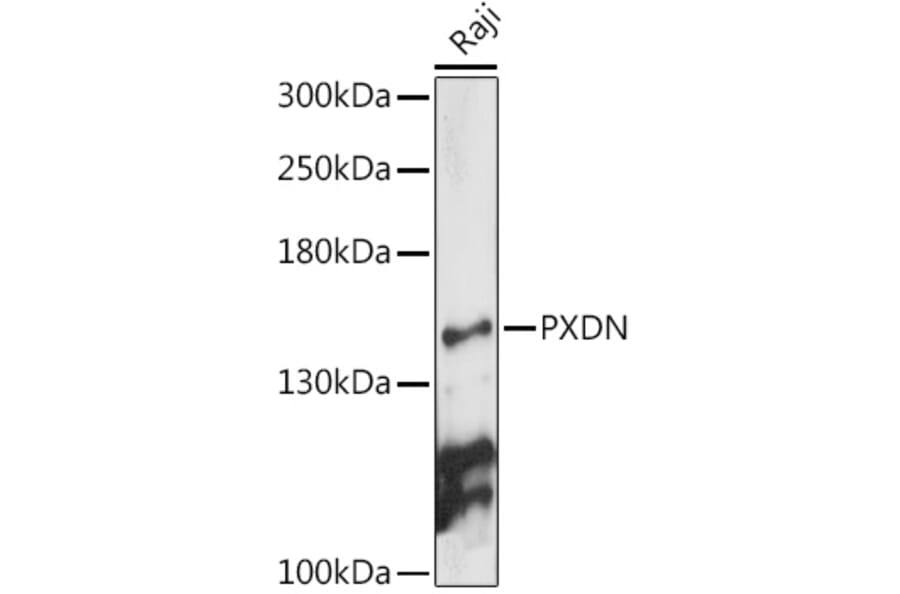 Western Blot - Anti-PXDN/VPO1 Antibody (A92694) - Antibodies.com