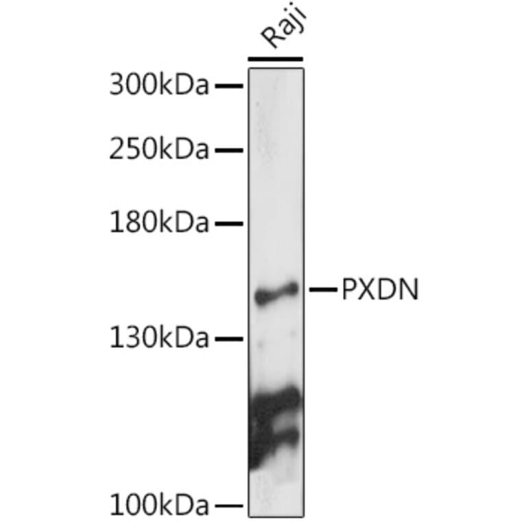 Western Blot - Anti-PXDN/VPO1 Antibody (A92694) - Antibodies.com