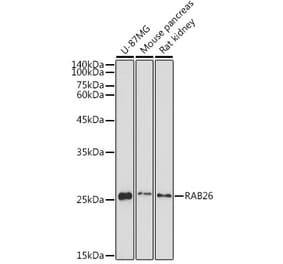 Western Blot - Anti-RAB26 Antibody (A92695) - Antibodies.com