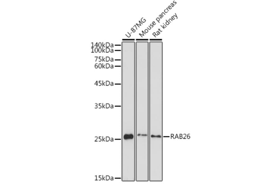 Western Blot - Anti-RAB26 Antibody (A92695) - Antibodies.com