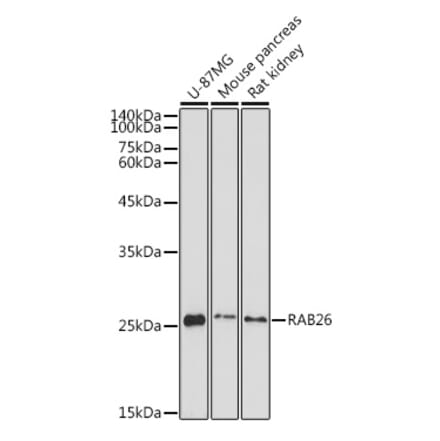 Western Blot - Anti-RAB26 Antibody (A92695) - Antibodies.com