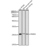 Western Blot - Anti-RAB26 Antibody (A92695) - Antibodies.com