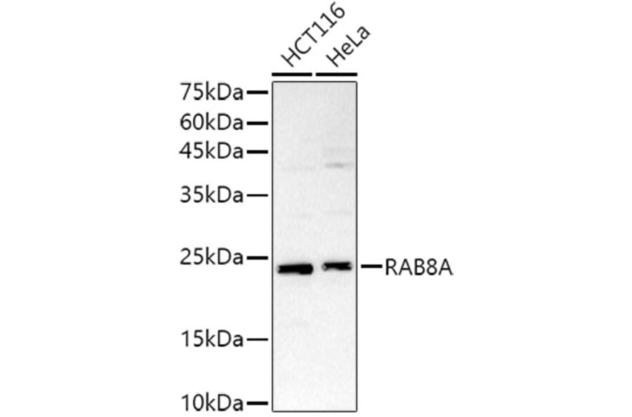 Western Blot - Anti-RAB8A Antibody (A92696) - Antibodies.com