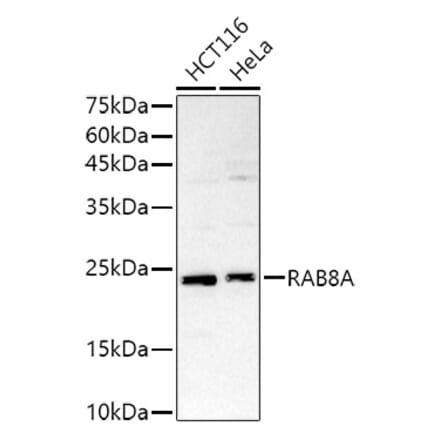 Western Blot - Anti-RAB8A Antibody (A92696) - Antibodies.com