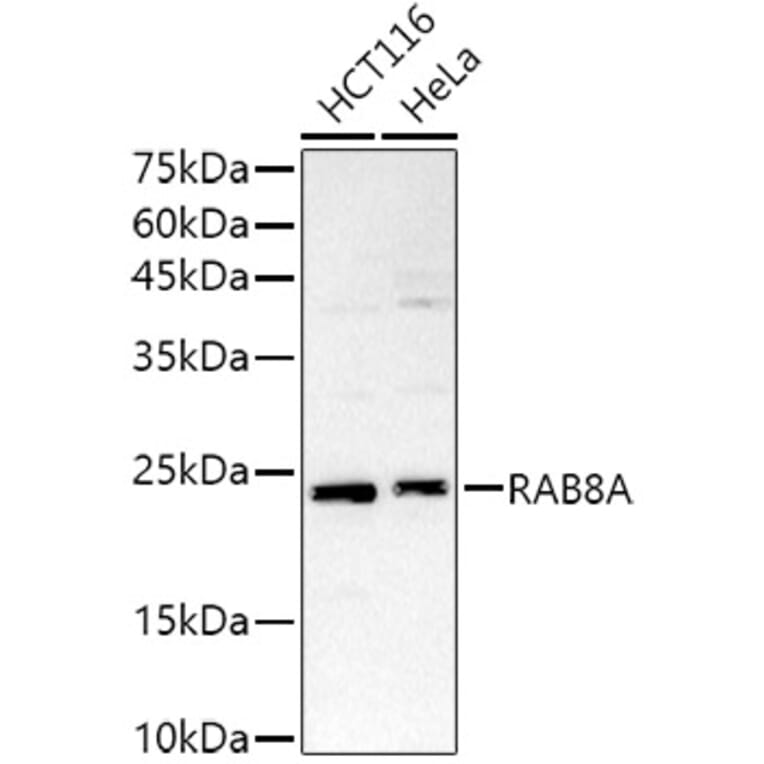 Western Blot - Anti-RAB8A Antibody (A92696) - Antibodies.com