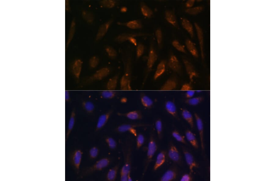 Immunofluorescence - Anti-RAB8A Antibody (A92696) - Antibodies.com