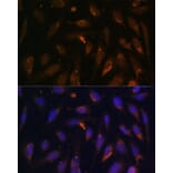 Immunofluorescence - Anti-RAB8A Antibody (A92696) - Antibodies.com