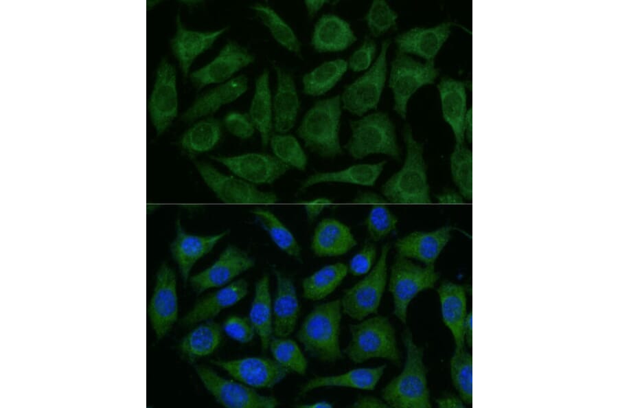 Immunofluorescence - Anti-GRF2 Antibody (A92697) - Antibodies.com