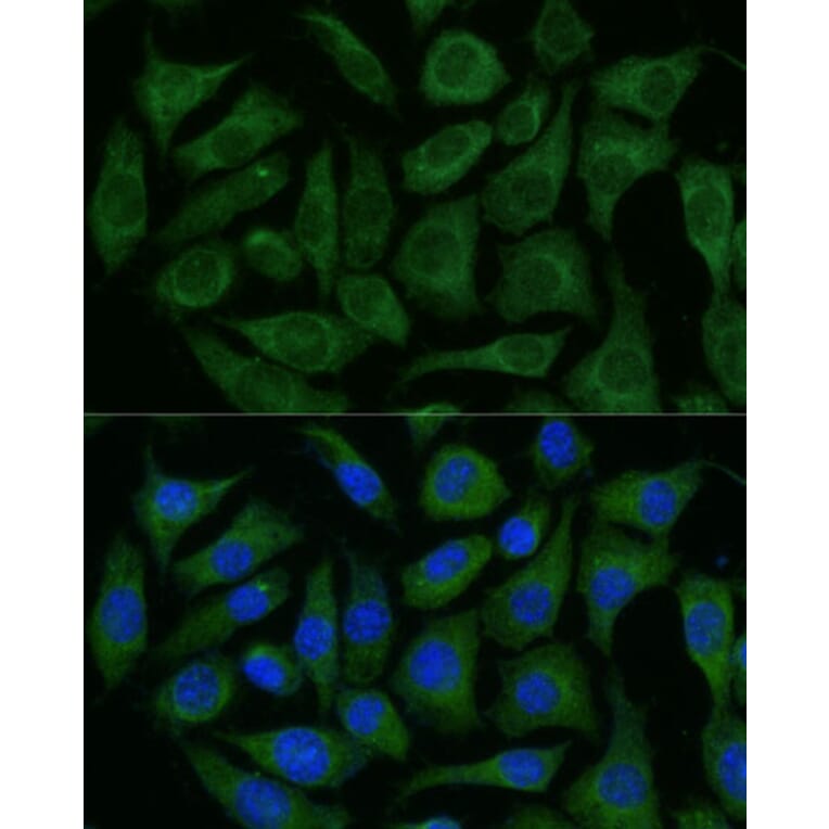 Immunofluorescence - Anti-GRF2 Antibody (A92697) - Antibodies.com