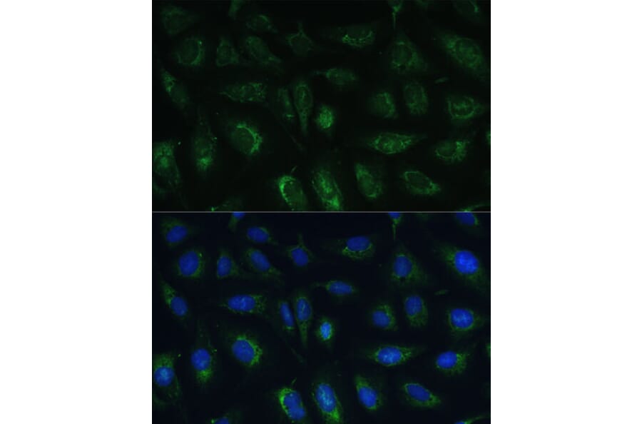 Immunofluorescence - Anti-GRF2 Antibody (A92697) - Antibodies.com