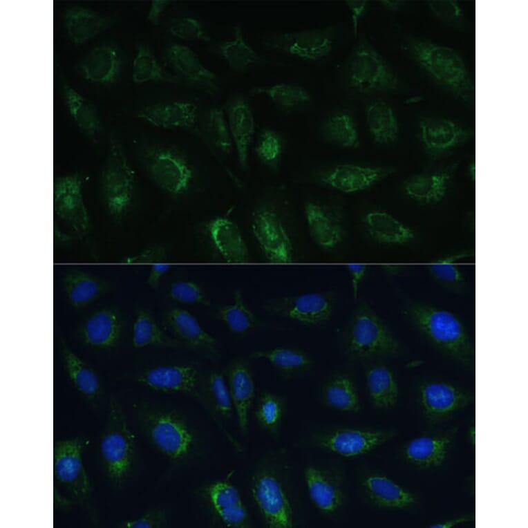 Immunofluorescence - Anti-GRF2 Antibody (A92697) - Antibodies.com