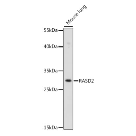 Western Blot - Anti-RASD2 Antibody (A92698) - Antibodies.com