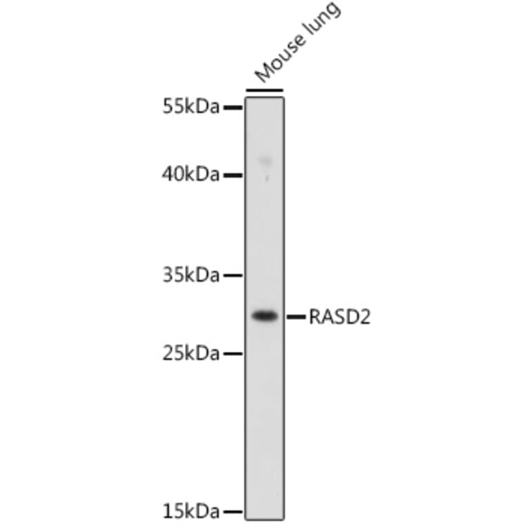 Western Blot - Anti-RASD2 Antibody (A92698) - Antibodies.com