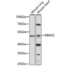 Western Blot - Anti-RBMS3 Antibody (A92700) - Antibodies.com