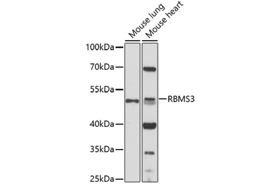 Western Blot - Anti-RBMS3 Antibody (A92700) - Antibodies.com