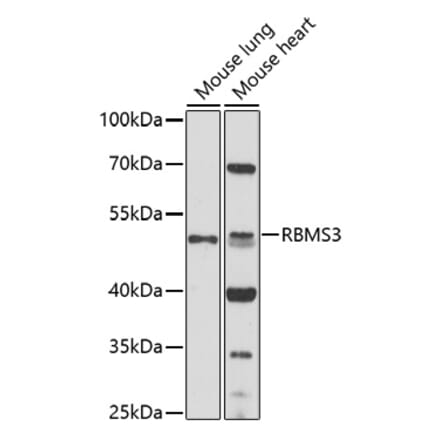 Western Blot - Anti-RBMS3 Antibody (A92700) - Antibodies.com