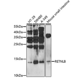 Western Blot - Anti-RELM beta Antibody (A92701) - Antibodies.com