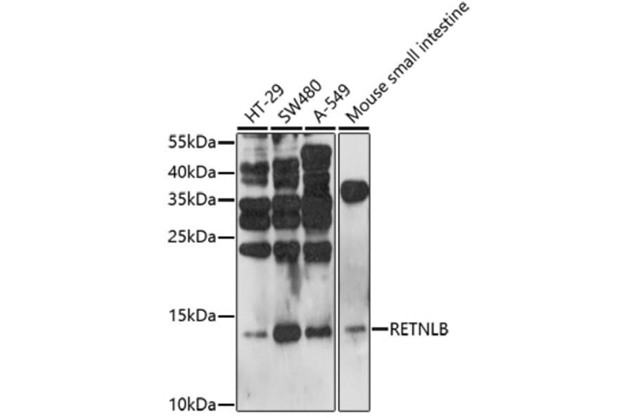 Western Blot - Anti-RELM beta Antibody (A92701) - Antibodies.com