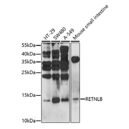 Western Blot - Anti-RELM beta Antibody (A92701) - Antibodies.com