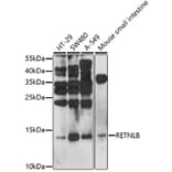 Western Blot - Anti-RELM beta Antibody (A92701) - Antibodies.com