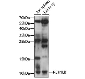 Western Blot - Anti-RELM beta Antibody (A92702) - Antibodies.com