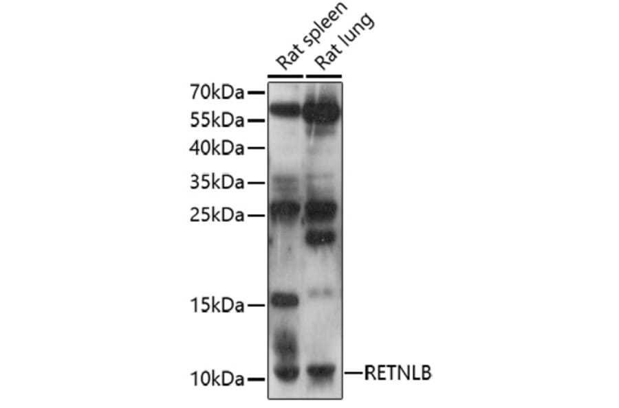 Western Blot - Anti-RELM beta Antibody (A92702) - Antibodies.com