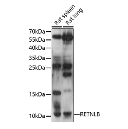 Western Blot - Anti-RELM beta Antibody (A92702) - Antibodies.com