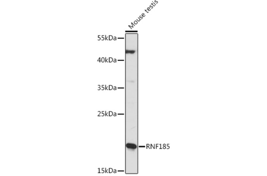 Western Blot - Anti-RNF185 Antibody (A92707) - Antibodies.com
