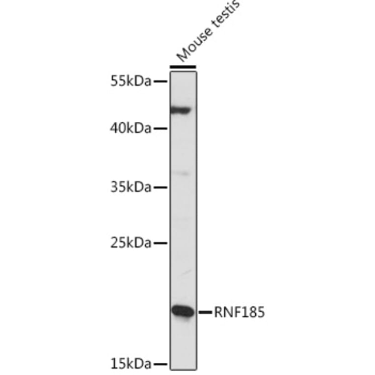 Western Blot - Anti-RNF185 Antibody (A92707) - Antibodies.com