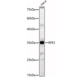 Western Blot - Anti-RPF2 Antibody (A92708) - Antibodies.com
