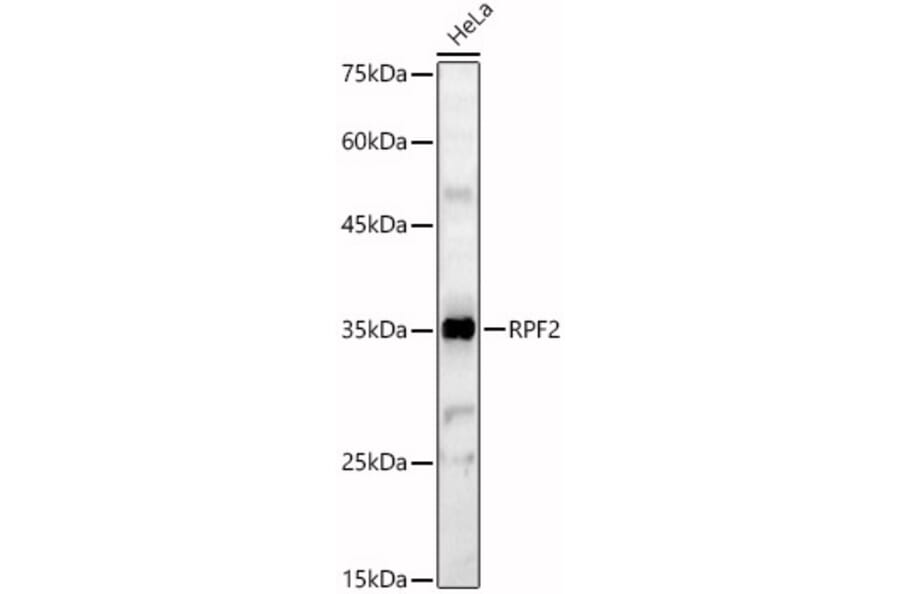 Western Blot - Anti-RPF2 Antibody (A92708) - Antibodies.com