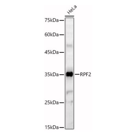 Western Blot - Anti-RPF2 Antibody (A92708) - Antibodies.com