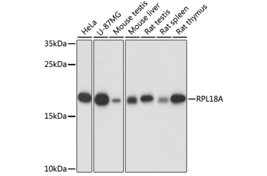 Western Blot - Anti-RPL18A Antibody (A92709) - Antibodies.com