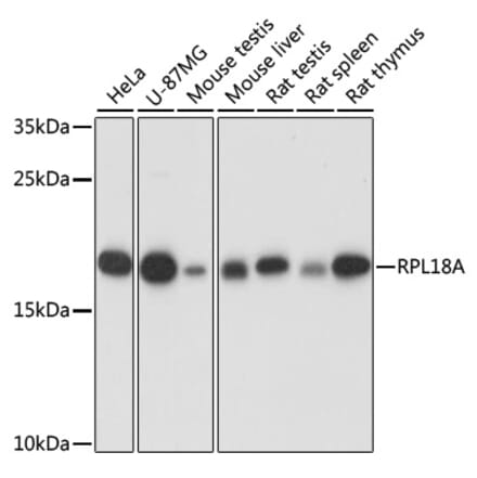 Western Blot - Anti-RPL18A Antibody (A92709) - Antibodies.com