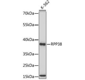 Western Blot - Anti-RPP38 Antibody (A92710) - Antibodies.com