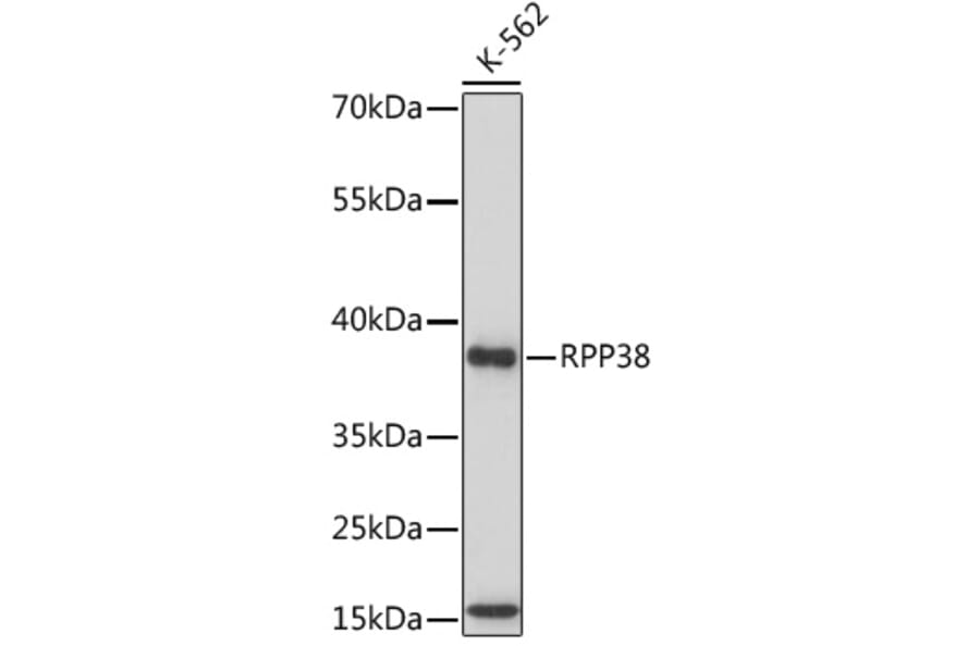 Western Blot - Anti-RPP38 Antibody (A92710) - Antibodies.com