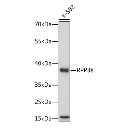 Western Blot - Anti-RPP38 Antibody (A92710) - Antibodies.com