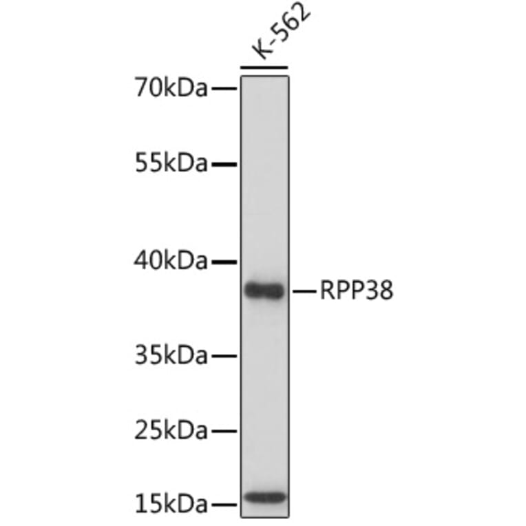Western Blot - Anti-RPP38 Antibody (A92710) - Antibodies.com