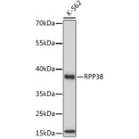 Western Blot - Anti-RPP38 Antibody (A92710) - Antibodies.com