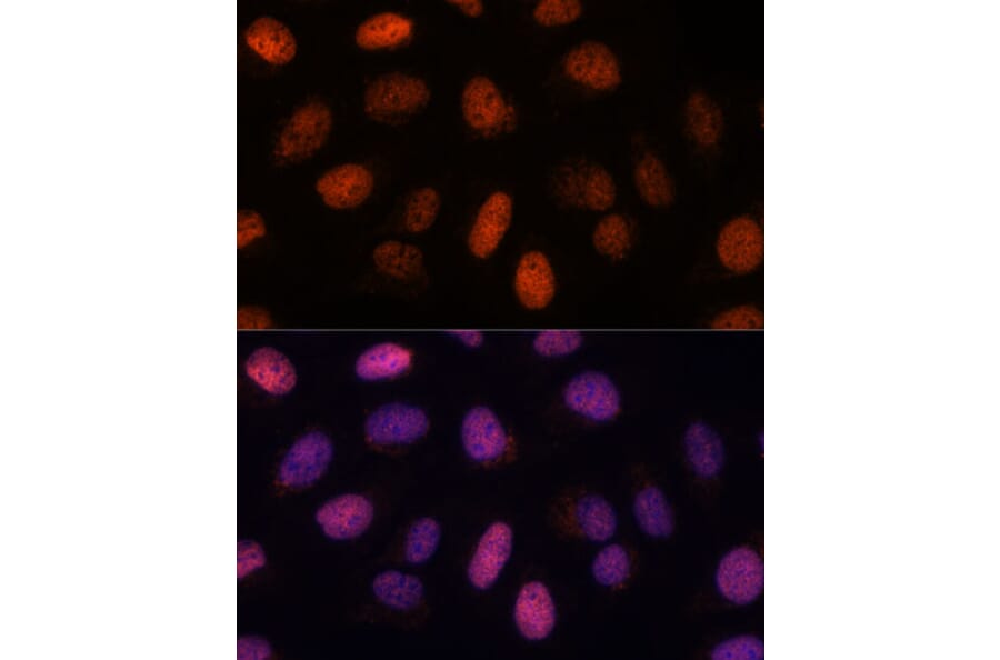 Immunofluorescence - Anti-RPP38 Antibody (A92710) - Antibodies.com
