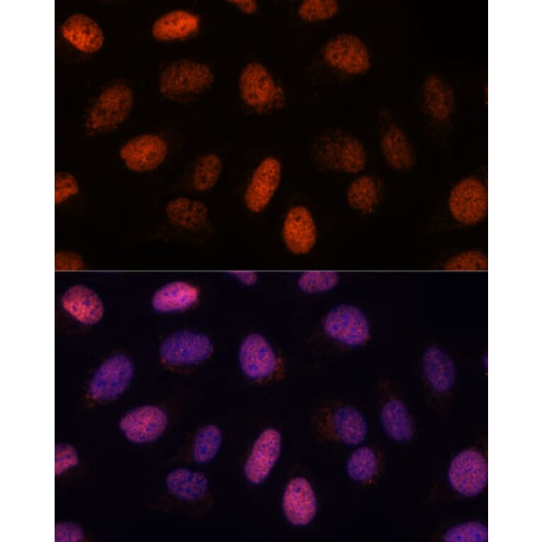 Immunofluorescence - Anti-RPP38 Antibody (A92710) - Antibodies.com