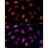 Immunofluorescence - Anti-RPP38 Antibody (A92710) - Antibodies.com