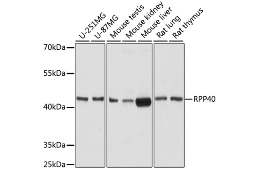 Western Blot - Anti-RPP40 Antibody (A92711) - Antibodies.com