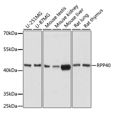 Western Blot - Anti-RPP40 Antibody (A92711) - Antibodies.com
