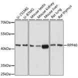 Western Blot - Anti-RPP40 Antibody (A92711) - Antibodies.com