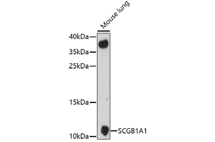 Western Blot - Anti-Uteroglobin Antibody (A92712) - Antibodies.com