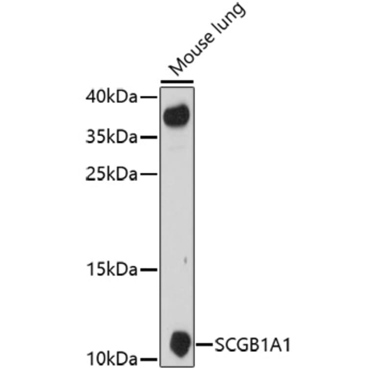 Western Blot - Anti-Uteroglobin Antibody (A92712) - Antibodies.com
