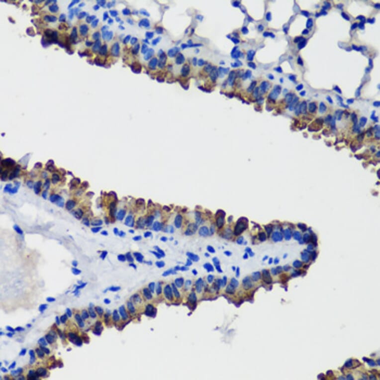 Immunohistochemistry - Anti-Uteroglobin Antibody (A92712) - Antibodies.com