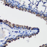 Immunohistochemistry - Anti-Uteroglobin Antibody (A92712) - Antibodies.com