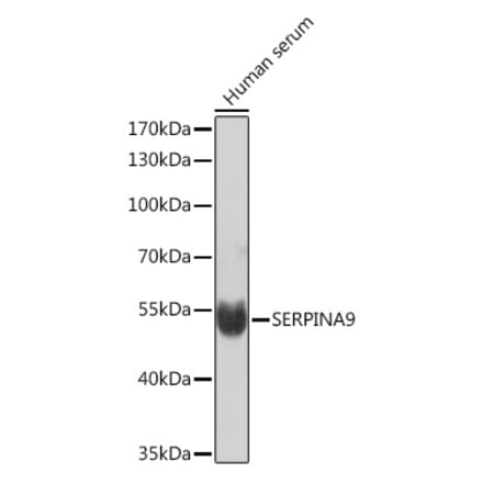 Western Blot - Anti-GCET1 Antibody (A92716) - Antibodies.com